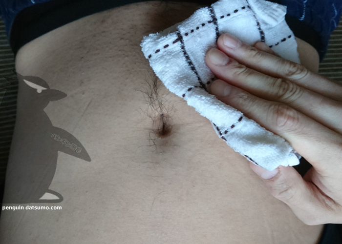 ケノンでギャランドゥを脱毛