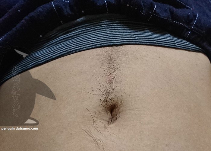 ケノンでギャランドゥ