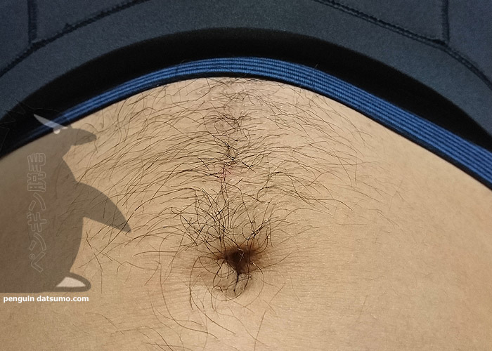 ケノンでギャランドゥ