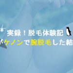 【男がケノンで腕脱毛した結果】画像付きで効果を完全検証【アトピー肌】