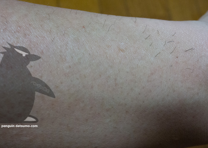 ケノンで腕脱毛してみた
