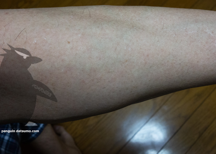 ケノンで腕脱毛6回目から2週間後