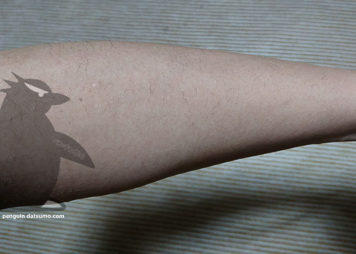 ケノンで腕脱毛したよ